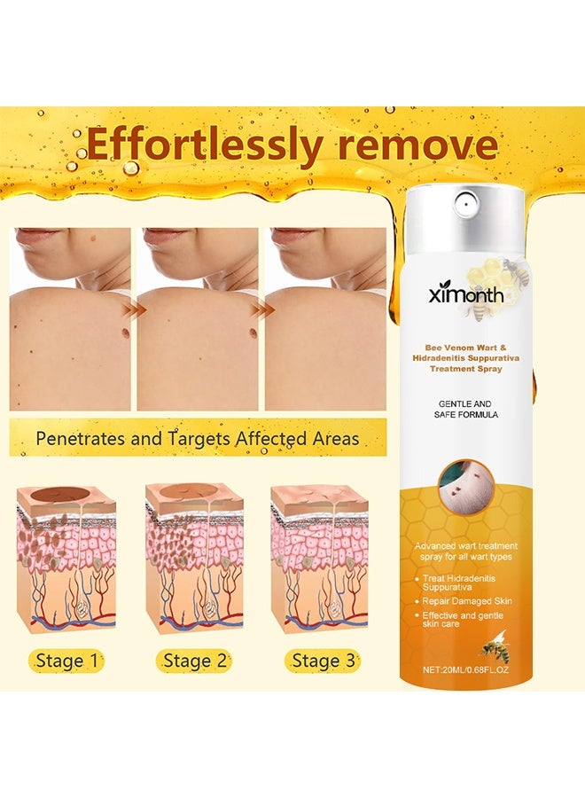 ximonth Bee Venom Wart Removal Spray, Bee Venom Wart Removal Solution, Wart Removal Freezer, Wart Removal Spray, Skin Tag Removal, Painless Removal Of Skin Tags And Moles 20ml - Image 5